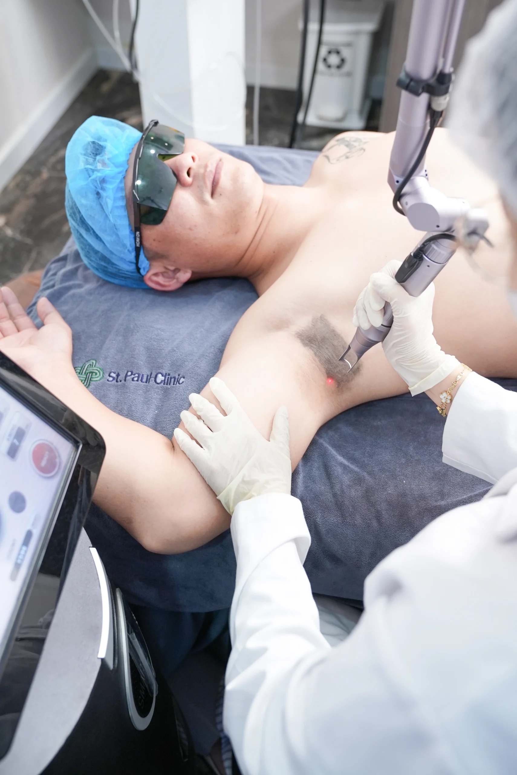 Bau Ketiak Menahun: Solusi Perawatan Aman dengan Teknologi Pure Ax